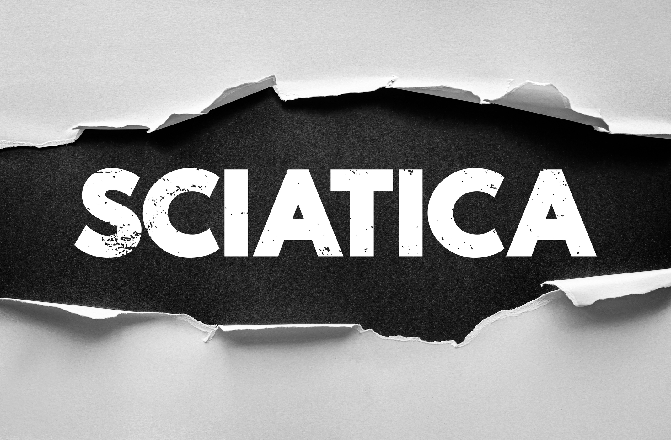 Causes of Sciatica